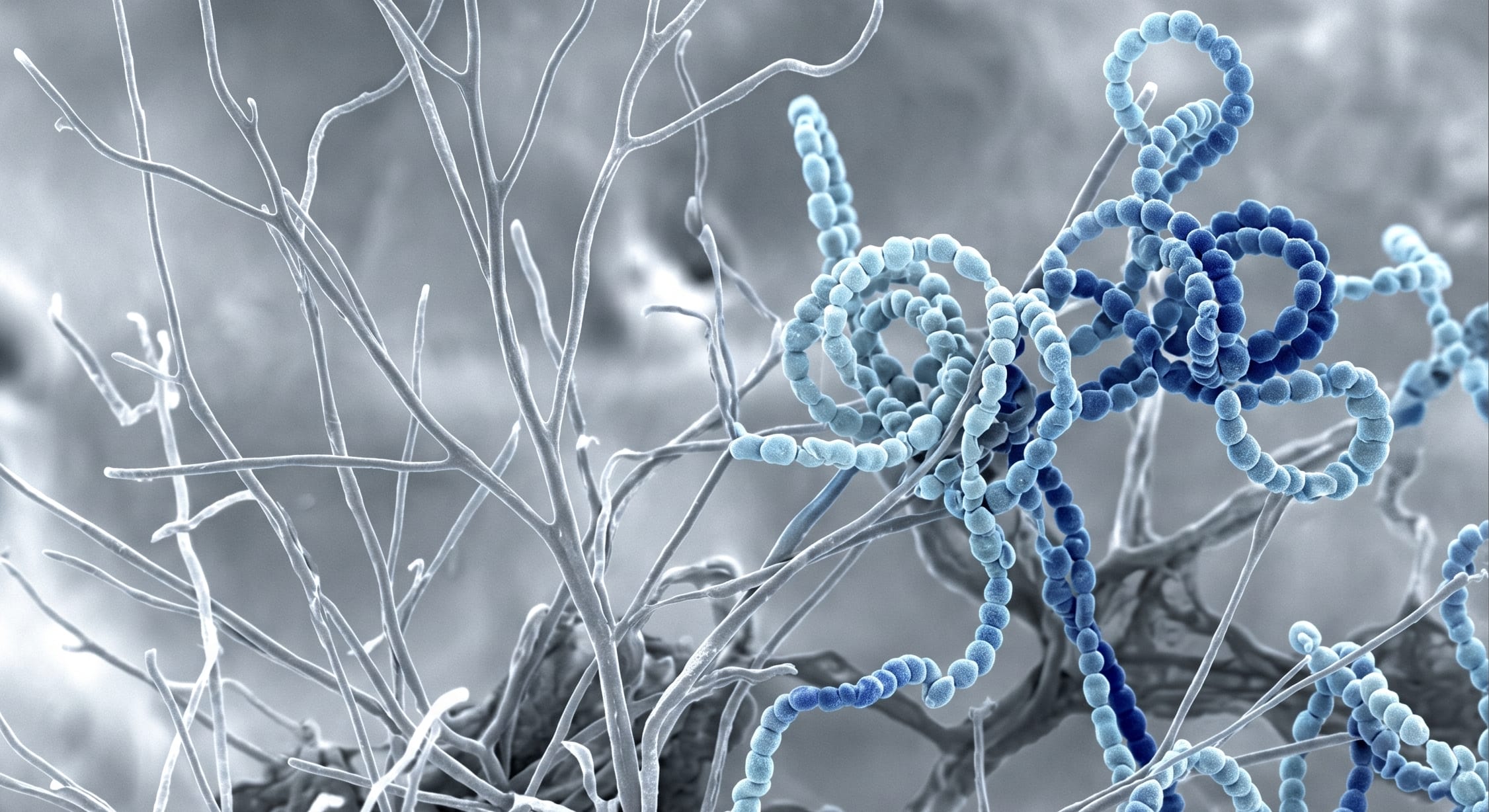 放线菌电镜照片效果图